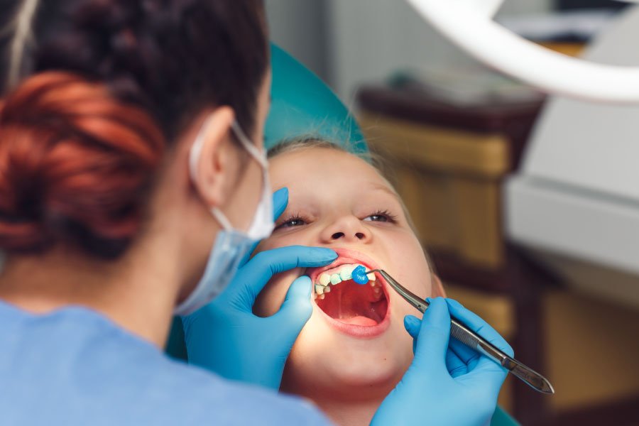 Fluoride Treatment