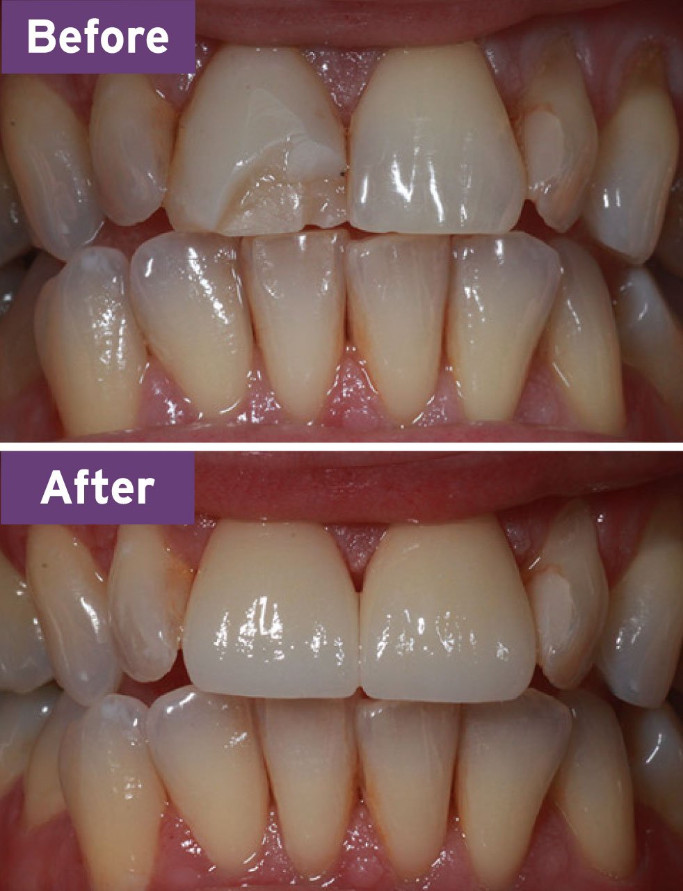 Lynnwood Dentist Smile Gallery