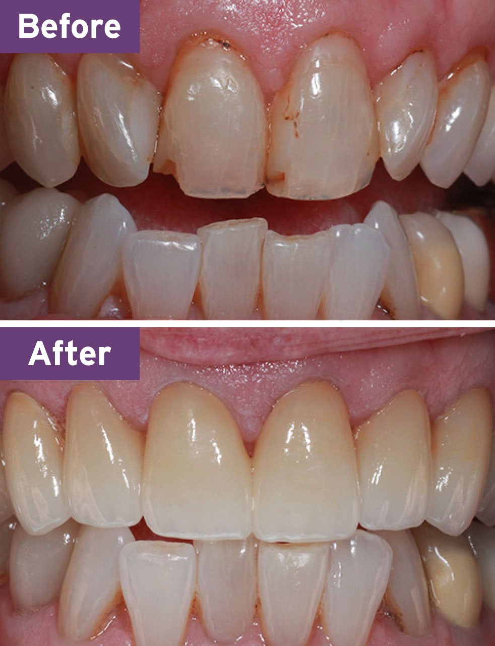 Lynnwood Dentist Smile Gallery