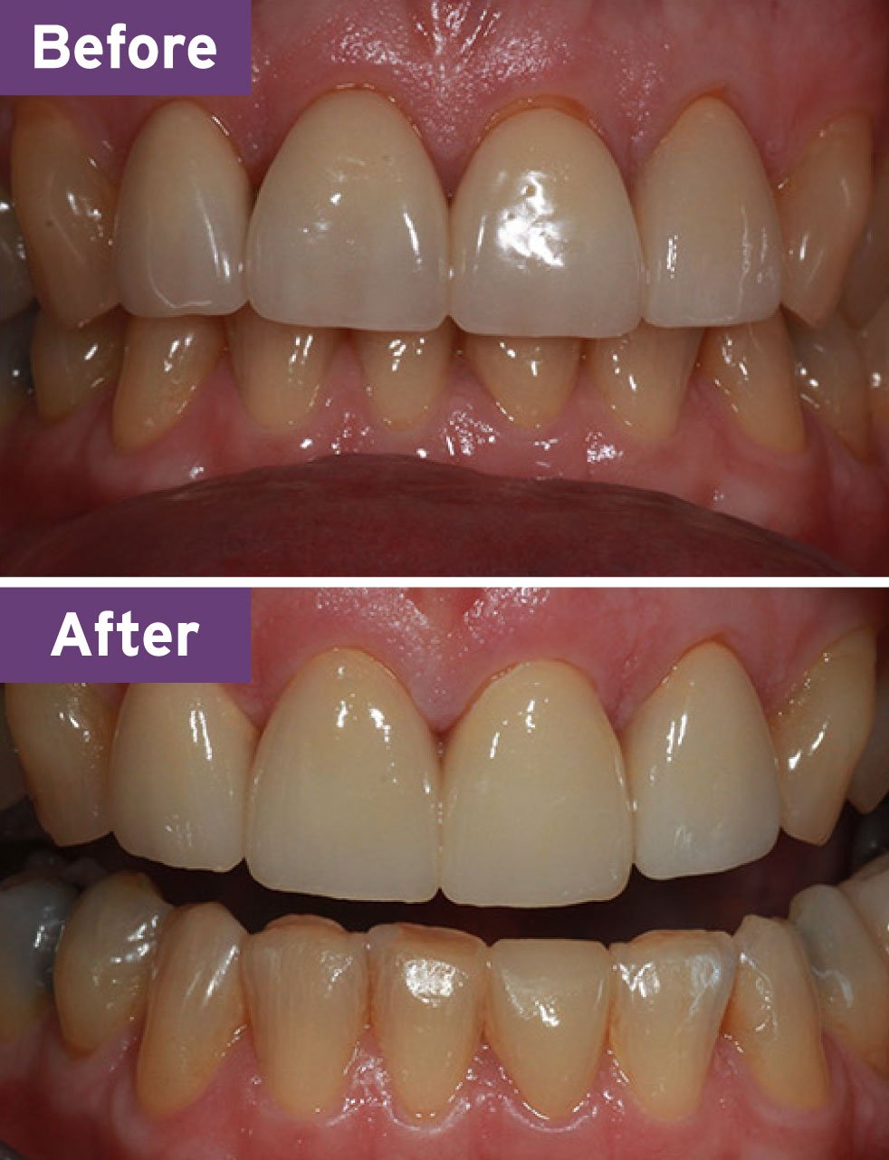 Lynnwood Dentist Smile Gallery