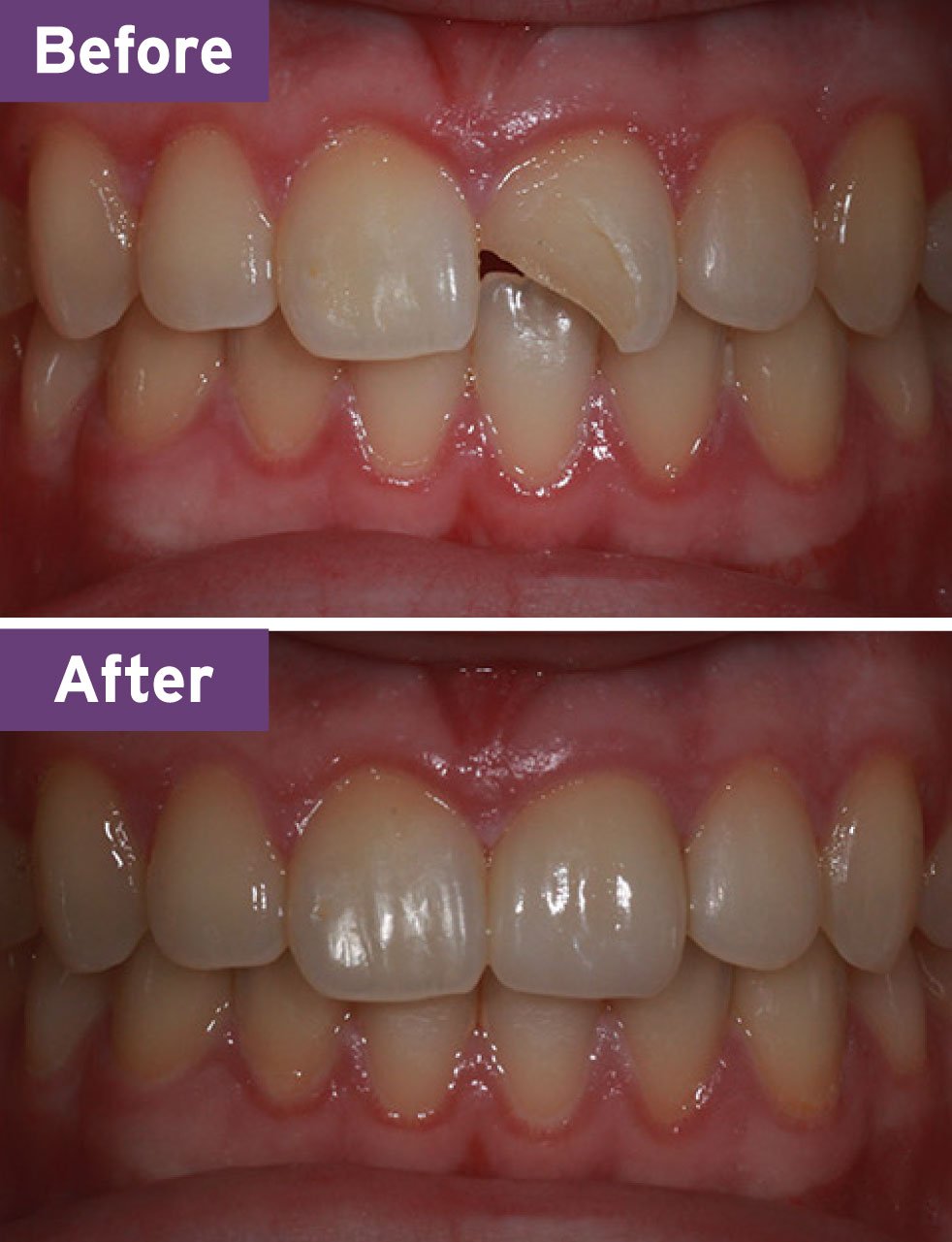 Lynnwood Dentist Smile Gallery