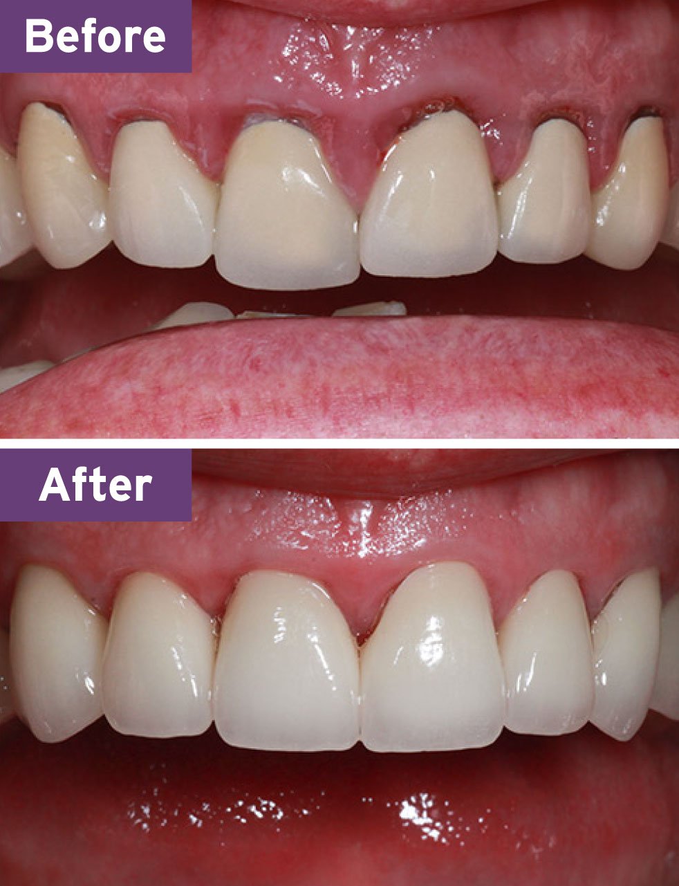 Lynnwood Dentist Smile Gallery