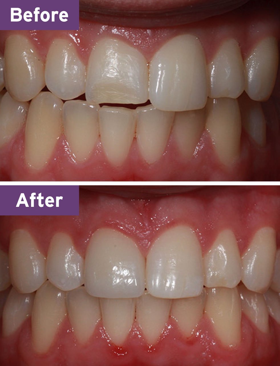 Lynnwood Dentist Smile Gallery