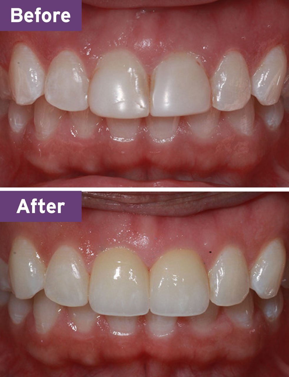 Lynnwood Dentist Smile Gallery