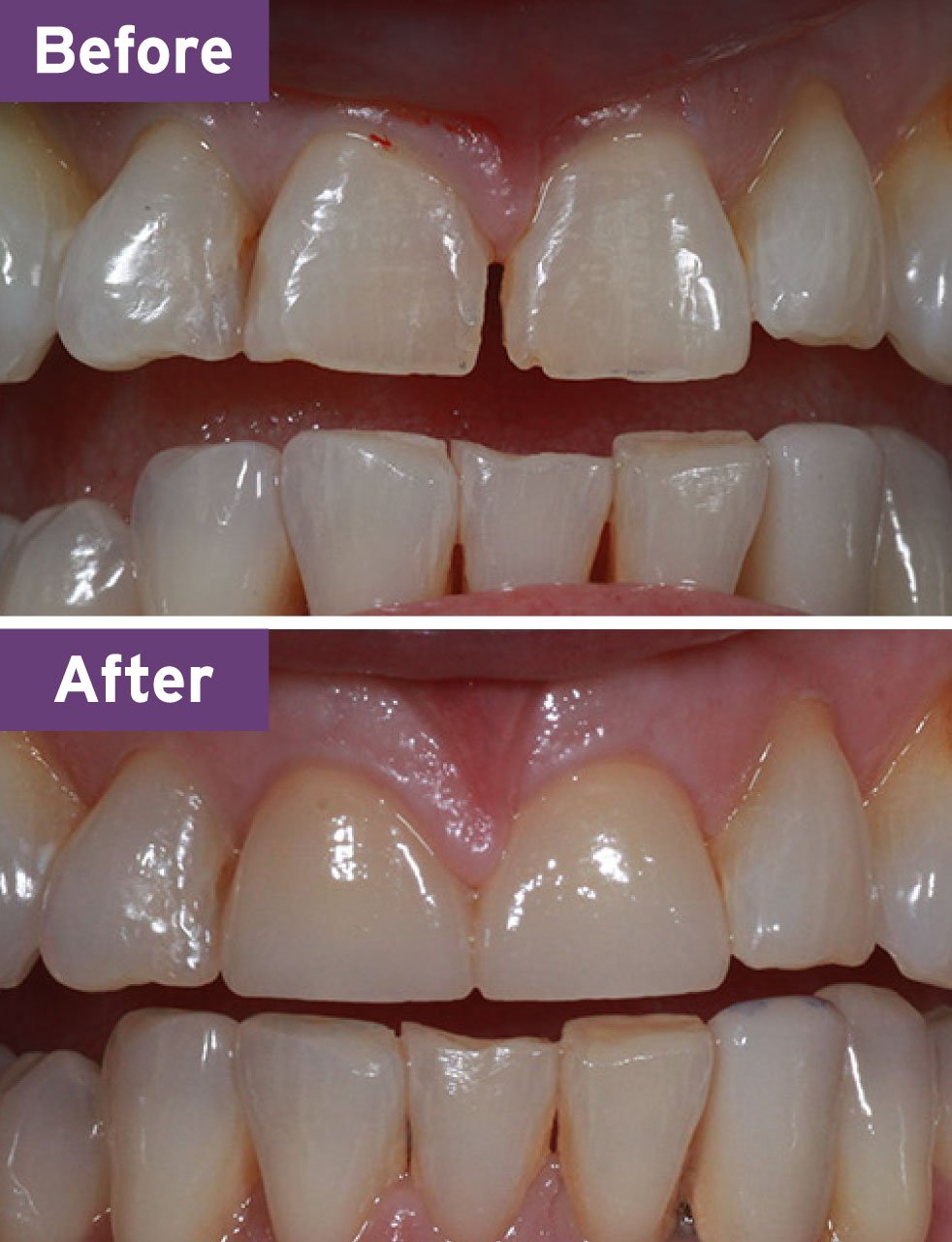 Lynnwood Dentist Smile Gallery