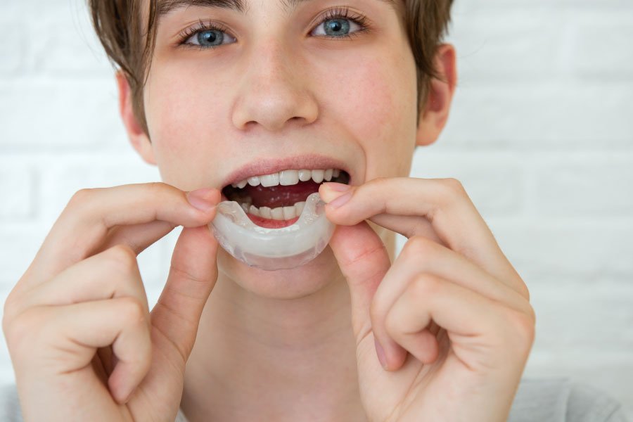 Mouthguards